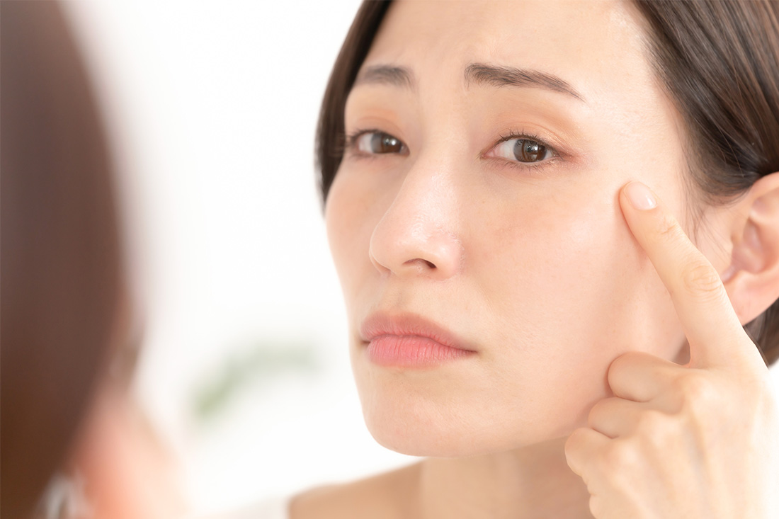 頬にできたシミを気にしている女性