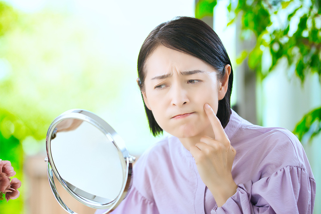 顔のしみを気にする40代女性