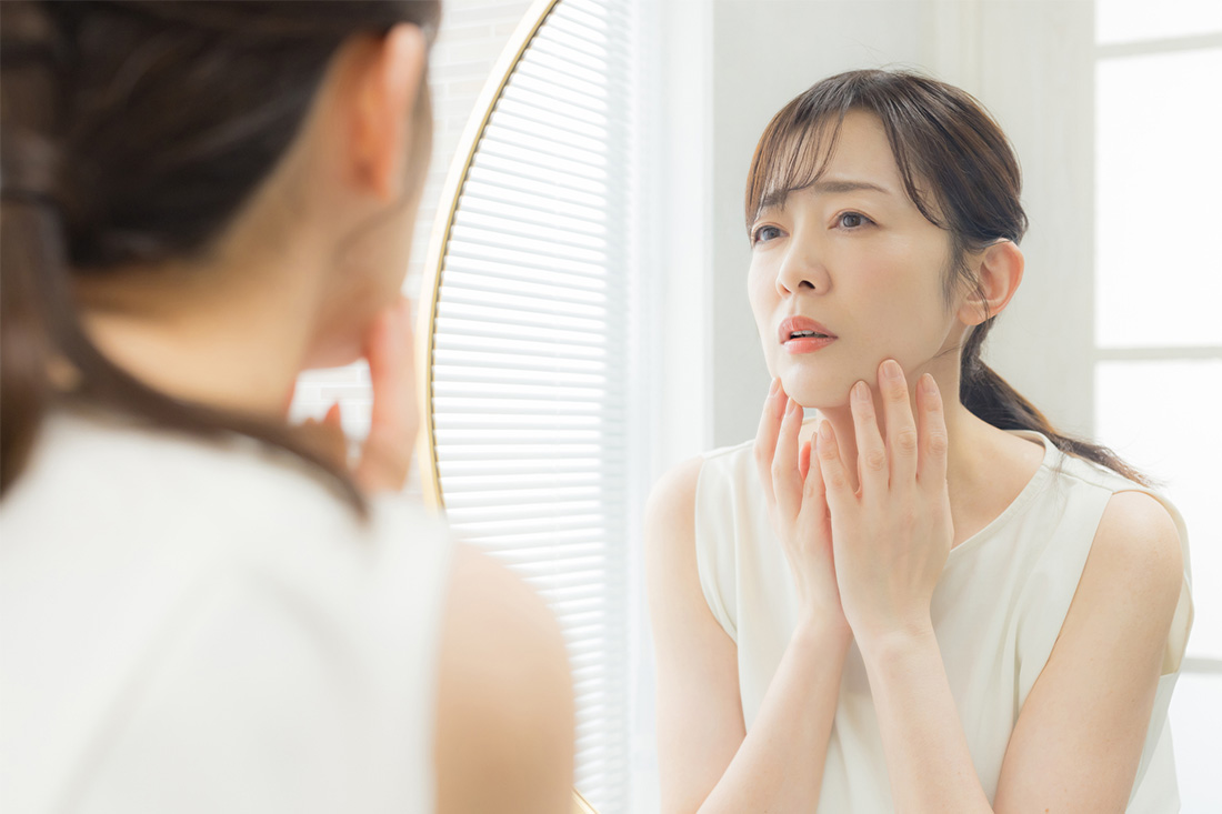 肌にできた色素斑に悩む女性