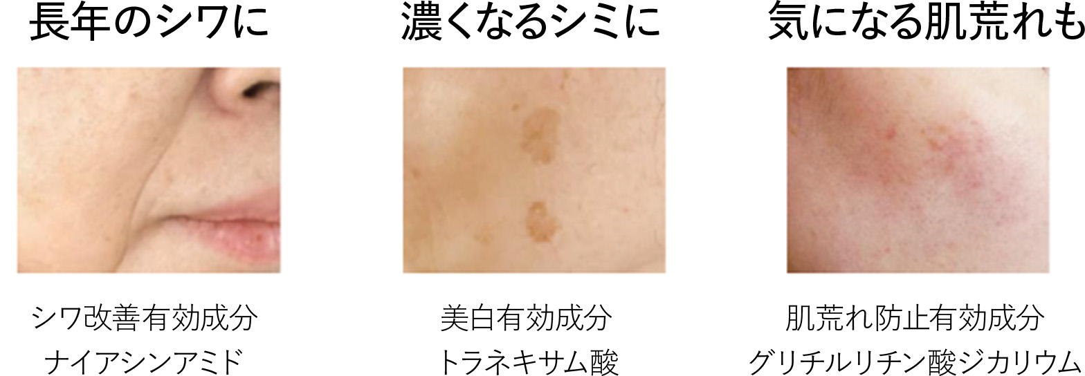 長年のシワに 濃くなるシミに 気になる肌荒れも